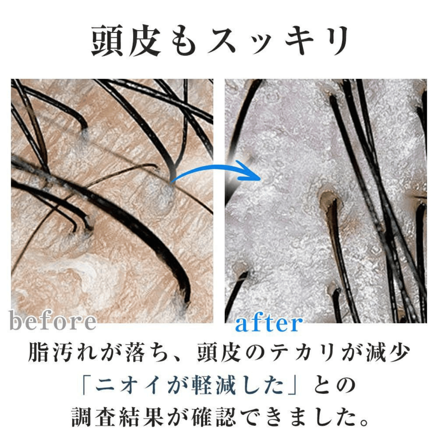 Sorano HadaPure™  ナノバブルで、毎日のシャワーが美肌習慣に。