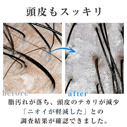 Sorano HadaPure™  ナノバブルで、毎日のシャワーが美肌習慣に。