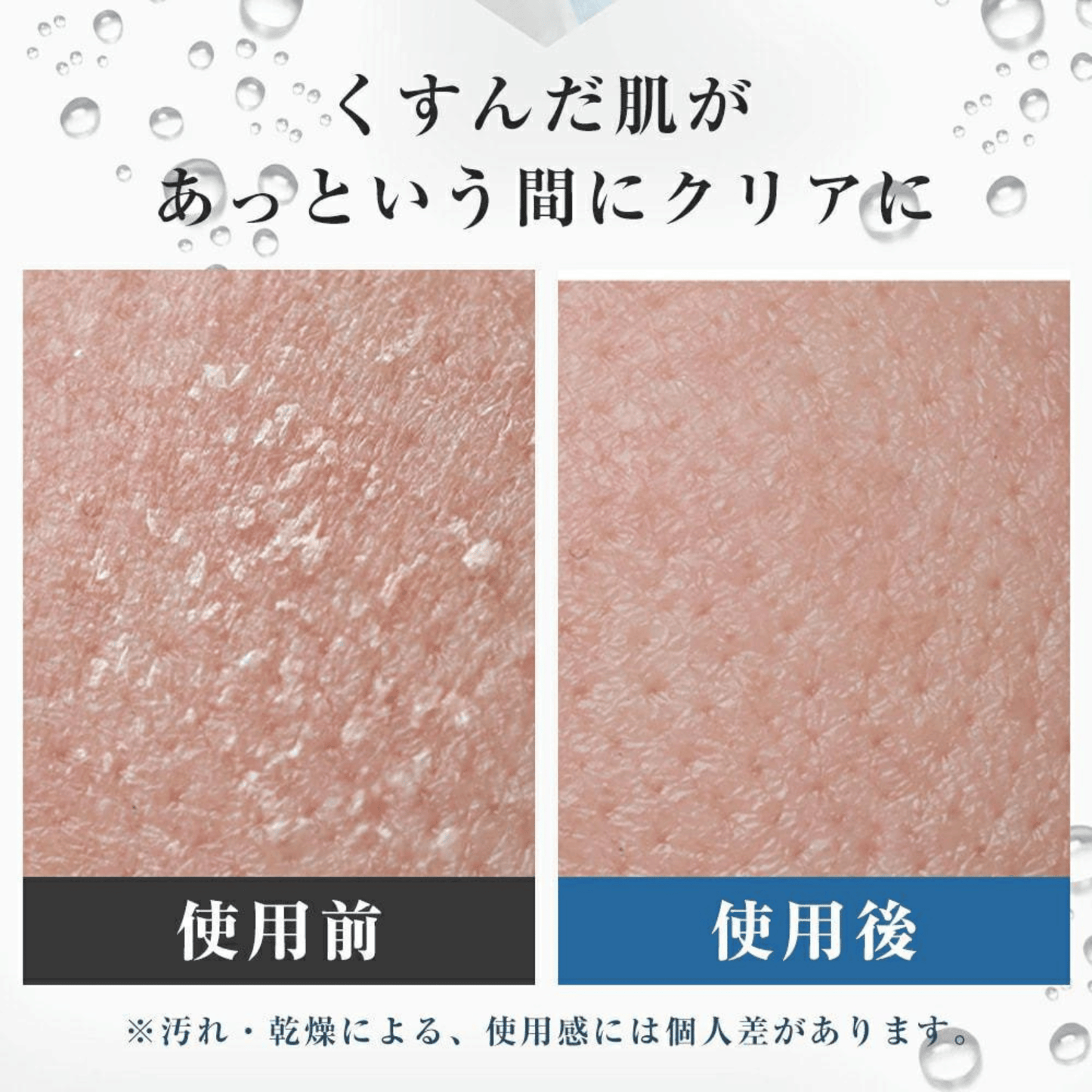 Sorano HadaPure™  ナノバブルで、毎日のシャワーが美肌習慣に。